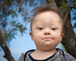 Portrait of baby boy with Down Syndrome